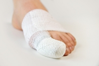 Is My Toe Sprained or Broken?