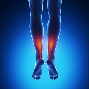 Painful Achilles Tendon Injury