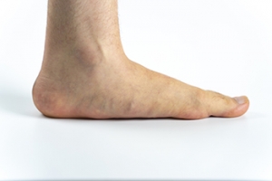 Do I Have Flat Feet?